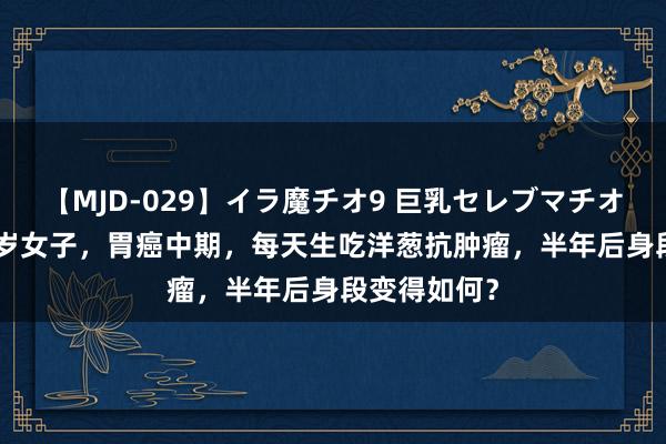 【MJD-029】イラ魔チオ9 巨乳セレブマチオ ユリア 56岁女子，胃癌中期，每天生吃洋葱抗肿瘤，半年后身段变得如何？